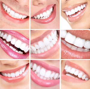 Richtige Zahnpflege für ein strahlendes Lächeln